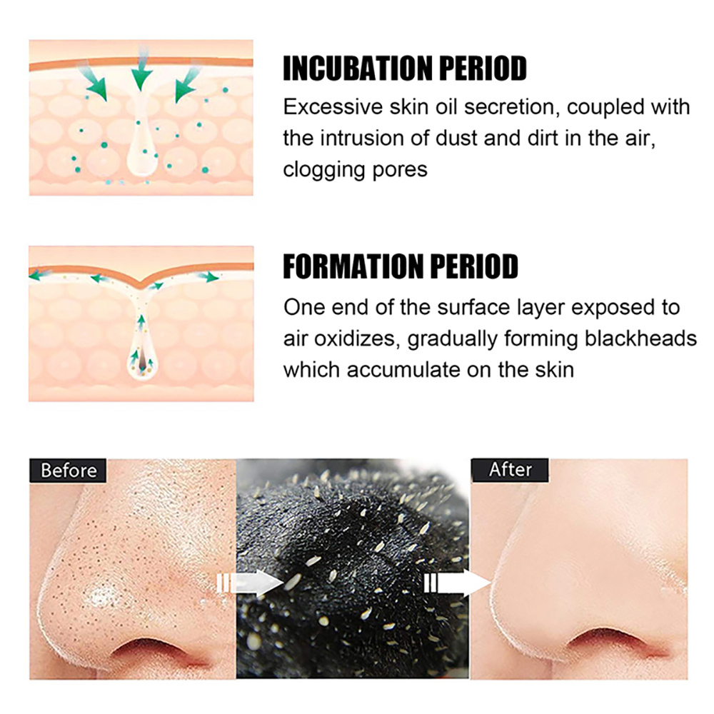 10-100Pcs Blackhead Remover Ma - Nasal Aspirator ulasan dan harga