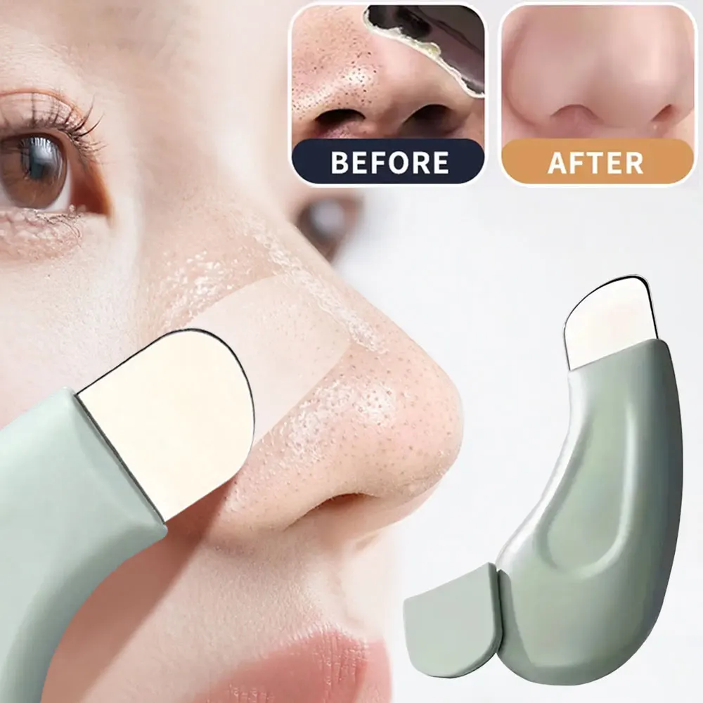 Facial Blackhead Removal Tool, - Nasal Aspirator ulasan dan harga